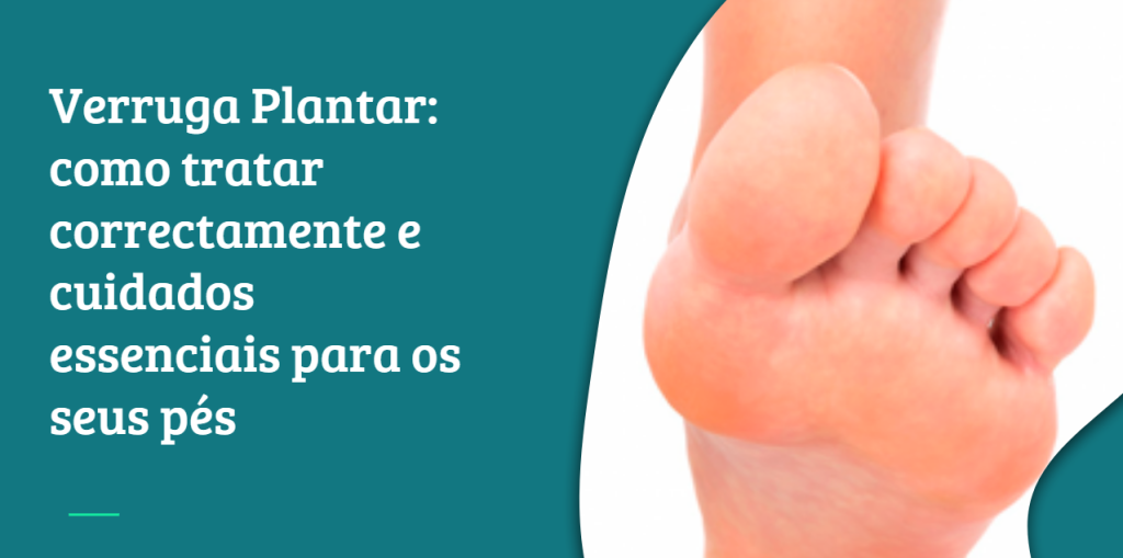 Verruga Plantar Como Tratar Correctamente E Cuidados Essenciais Para verruga-plantar-como-tratar-correctamente-e-cuidados-essenciais-para